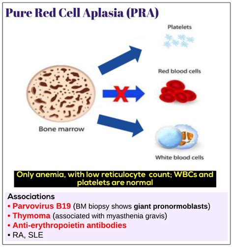 Pure Red Cell Aplasia Medicine Keys For Mrcps