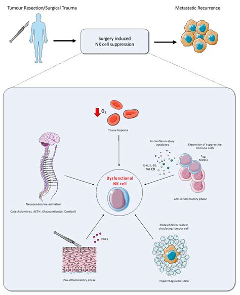 Ijms Free Full Text Postoperative Natural Killer Cell Dysfunction