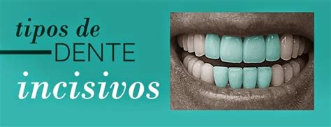 Clinica Dentaria Mais Sorriso Saiba Para Que Serve Cada Dente Da Sua Boca