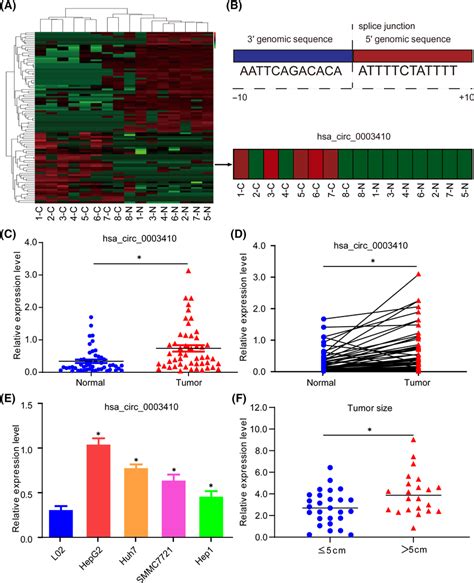 High Expression Of Hsa Circ In Hcc And Its Correlation With