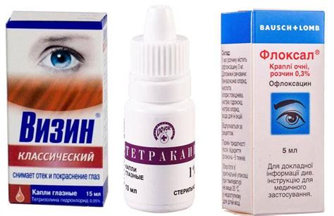Болят глаза от сварки что делать и как лечить, эффективные глазные капли