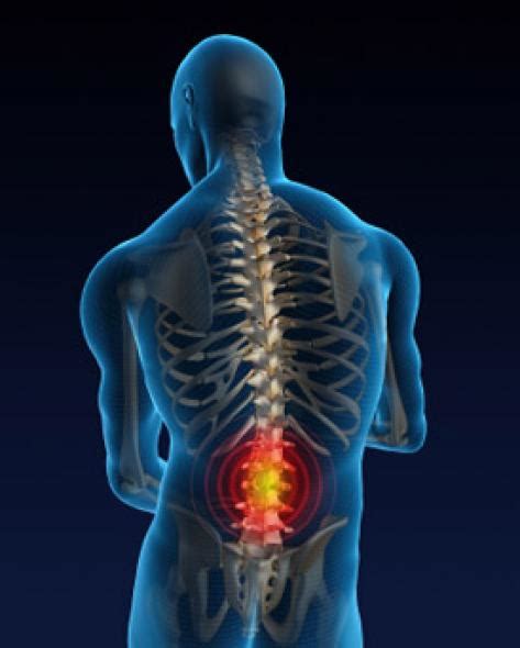 Back Pain Symptoms: Signs and Symptoms of Back Pain - HealthNormal