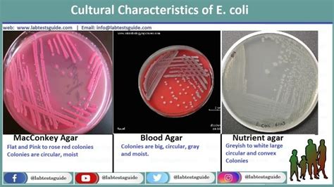 Urine Culture Interpretation Identification And More Lab Tests Guide