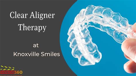 What Is Clear Aligner Therapy Dr Michael Costa Youtube