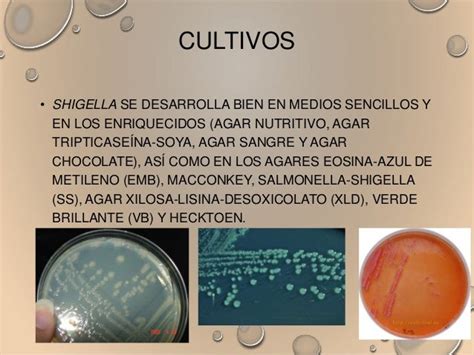 Shigella