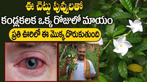 Conjunctivitis Kalla Kalaka Remedy