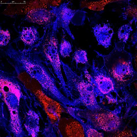 What Are Mesenchymal Stem Cells? - stemcellreference