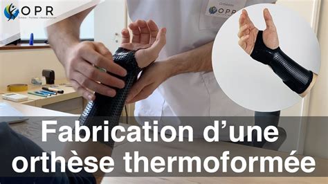 Fabrication D Une Orth Se Attelle Sur Mesure En Minutes Syndrome