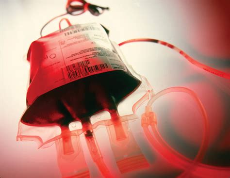 Blood Transfusion Strategies And Ecmo During The Covid Pandemic