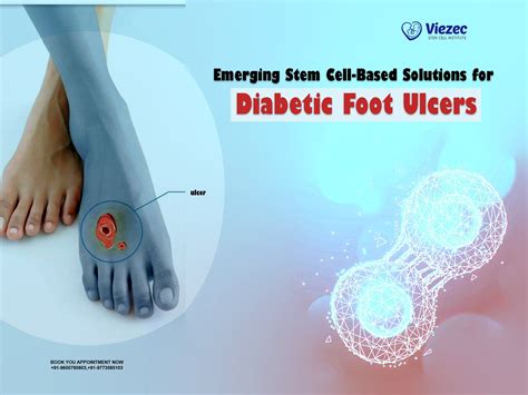 Emerging Stem Cell Based Solutions For Diabetic Foot Ulcers