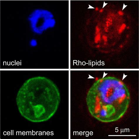 Fluorescence Confocal Microscopy Analysis Of A Prbc Showing The