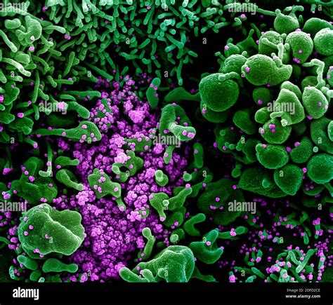 Colorized Scanning Electron Micrograph Of An Apoptotic Cell Green