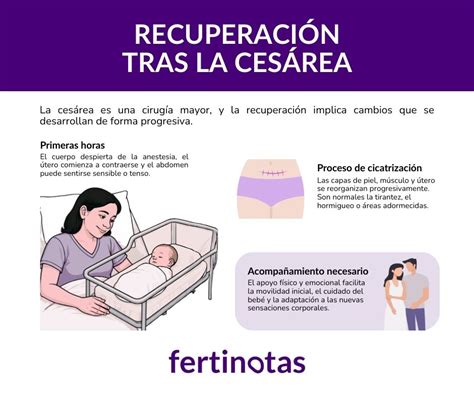 Cesárea Quanto Tempo De Repouso - Recuperación tras cesárea: qué esperar y cómo cuidarte - Fertinotas