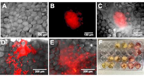 An Ex Vivo Model Of Ovarian Cancer Peritoneal Metastasis Using Human