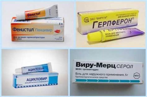 Герпес как выглядит на губе – Герпес на губах – лечение, фото, мазь от ...