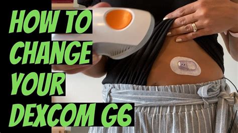 How To Change Your Dexcom G Cgm Easy To Follow Guide In