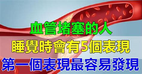 血管是生命通道！睡覺時「有5個表現」血管堵塞了 做好2件事：預防血栓 愛經驗20