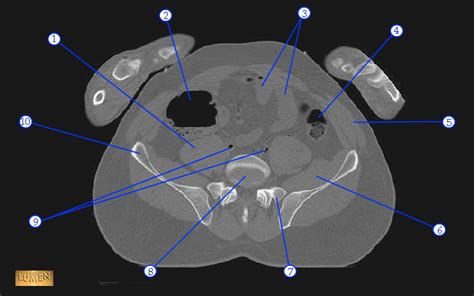 Pelvis Cross Section