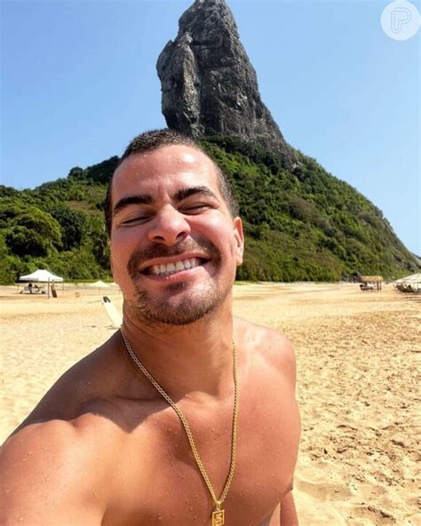 Foto Thiago Martins brinca acidente no trabalho Depois eles não