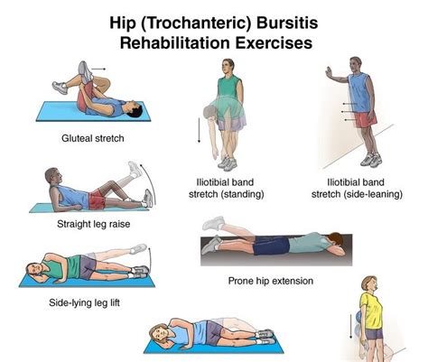 Ischial Tuberosity Bursitis Exercises | Hot Sex Picture