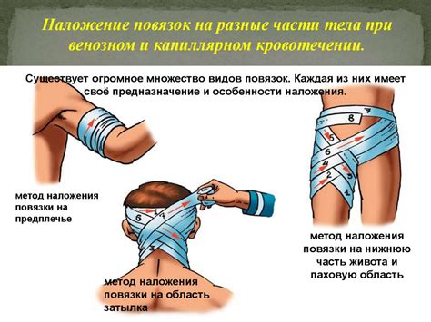 Первая медицинская помощь при ранениях. Основные правила оказания ...