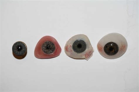 Prosthetic Eyes New Zealand Prosthetic Eye Service