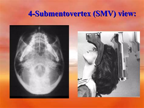 Extra Oral Radiology Techniques I Ppt