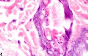 Skin - Necrosis - Nonneoplastic Lesion Atlas