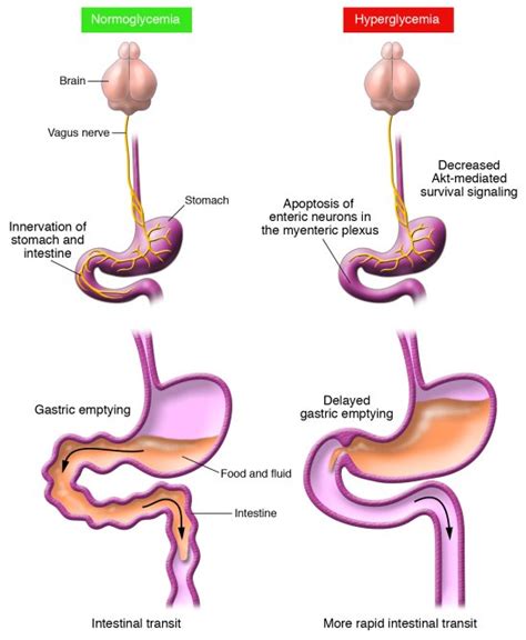 Gastrointestinal motility; Intestinal Motility