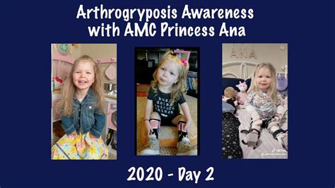 2020 Arthrogryposis Awareness With Amc Princess Ana Day 2 Youtube