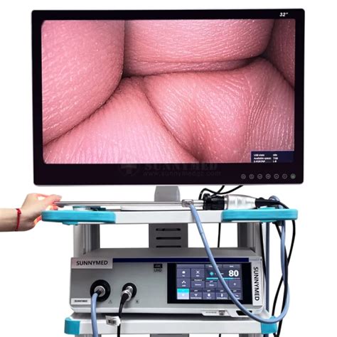 Ultra K Endoscope Camera System For Arthroscopy Ent Pted Cystoscope