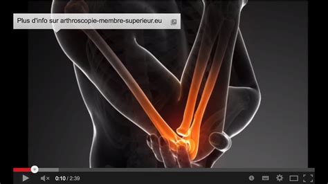 Chirurgie du coude sous arthroscopie pour une fracture de la tête