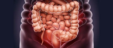 O Que Sao Polipos Intestino - Pólipos de Intestino Grosso: Sintomas, Tipos e Riscos