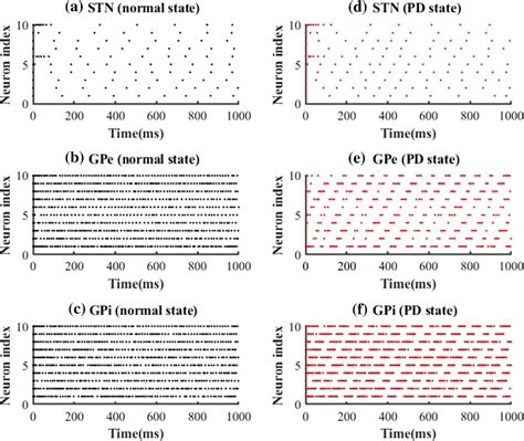 Firing Rastergrams Of STN GPe And GPi Neurons Under Normal A B And