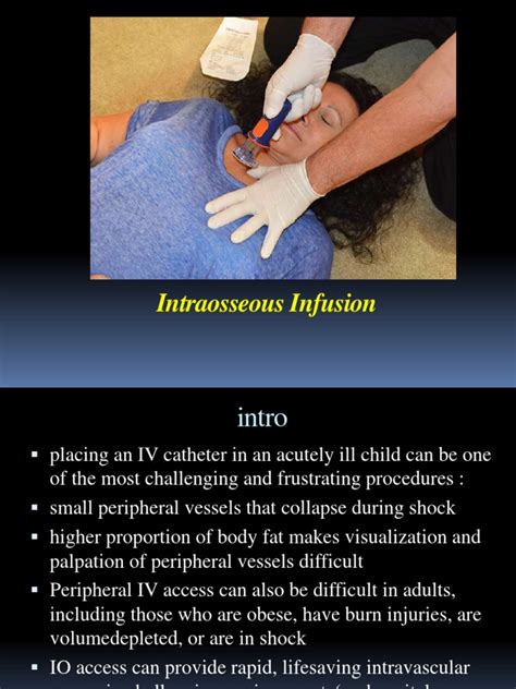 Intraosseous Infusion | PDF | Intravenous Therapy | Medical Procedure/Test