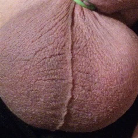 Cock And Ball Elastrator Banding Gay Penis Ring Porn Feat Prallo Xhamster