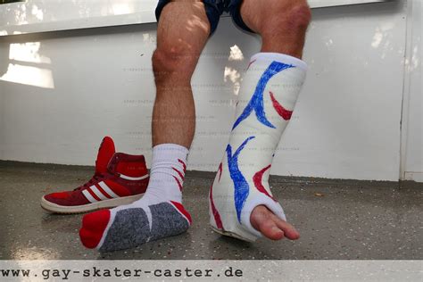 Leg Casts Page The Gay Skater Caster