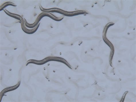 Earthworm Under Microscope