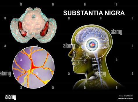 Substantia Nigra Computer Illustration Showing A Healthy Substantia