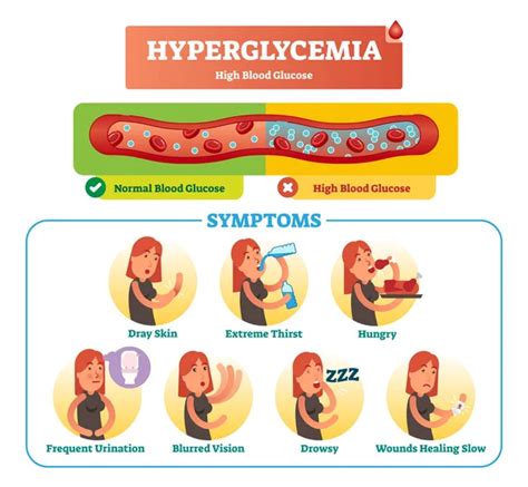 Conjunto De Colección De Ilustración Vectorial Hiperglucemia Síntoma