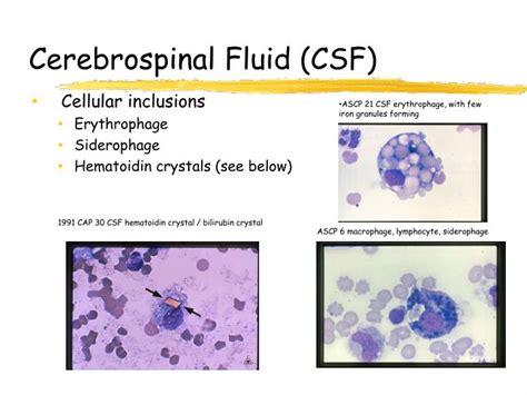 Ppt Urinalysis And Body Fluids Crg Powerpoint Presentation Id1172195