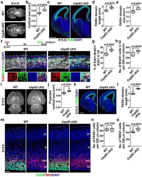 Centrosome Anchoring Regulates Progenitor Properties And Cortical