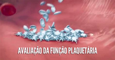 4 Técnicas Para Avaliar A Função Plaquetária Biomedicina Padrão