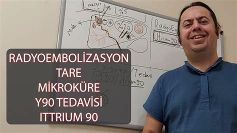 Tare Radyoembolizasyon İtrium90 Y90 Mikroküre Tedavisi Youtube