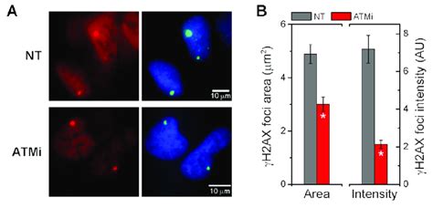 Figure S3 Inhibition Of DNA Damage Response By ATMi Reduces The