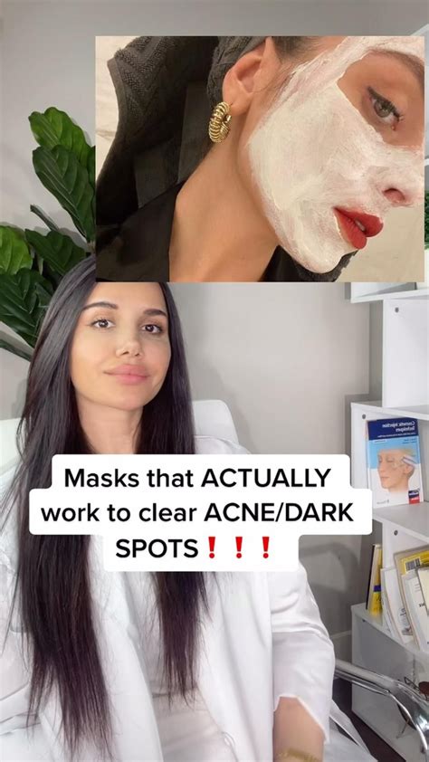 Get Rid Of Acne Dark Spots Artofit