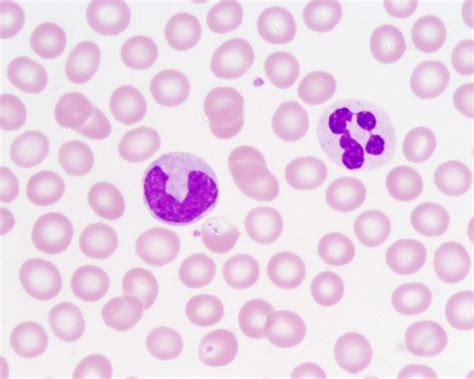 Neutrophil and monocyte - human blood smear (Wright's stain) | Flickr ...