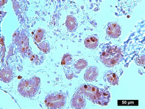 Protein Lysate Of Pure Human Normal Mammary Gland Epithelial Cells