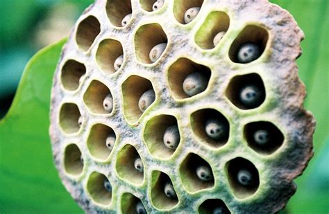 Skin Disease Trypophobia Lotus Seed Pod