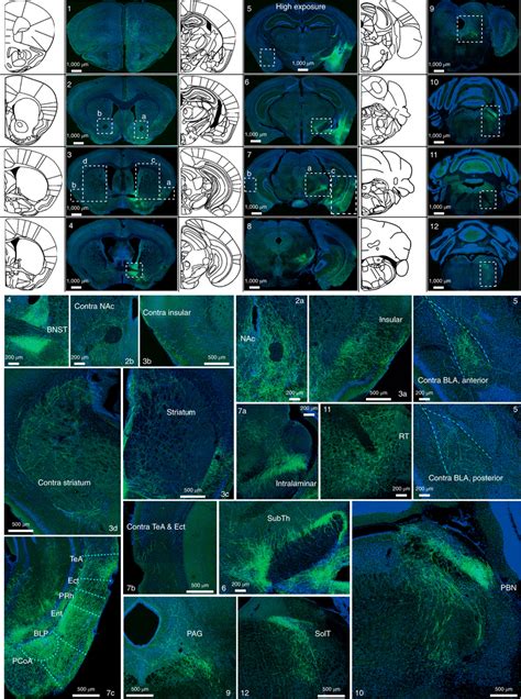 Whole Brain Mapping Of Axonal Projections From Ceaga Neurons Top